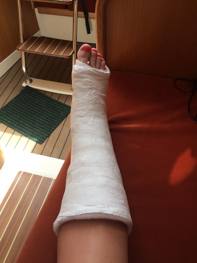 Gips fuß in Lomatuell Pro